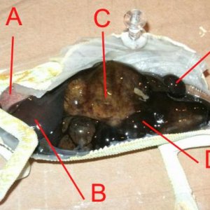 A: lung tissue
B: liver
C: either stomach or distended intestines
D: distended intestines
E: testicle