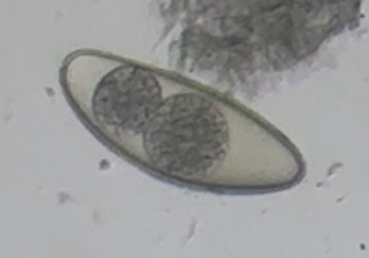 Pinworm egg.jpg