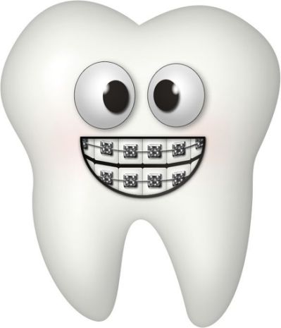 Tooth With Braces Clipart 10.jpg.cf.jpg