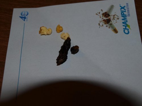 normal poop.jpg
