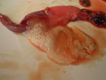 Stomach showing slimy foam.jpg