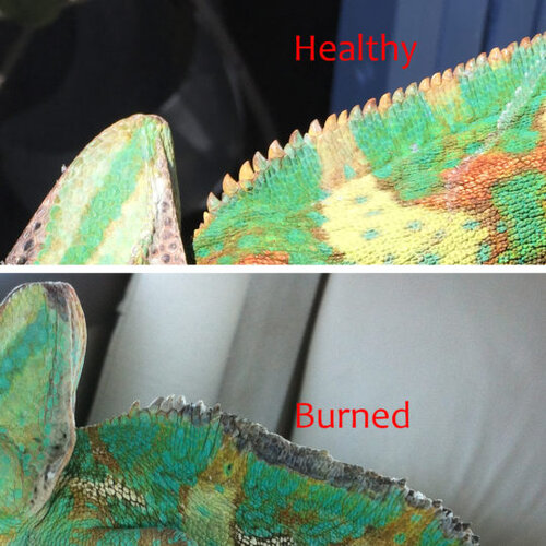 thermal burn.jpg