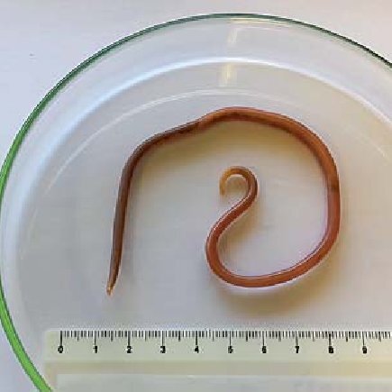 Macroscopic-evaluation-of-the-Ascaris-lumbricoides-worm_Q640-1.jpg