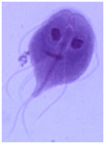 stained giardia.jpg
