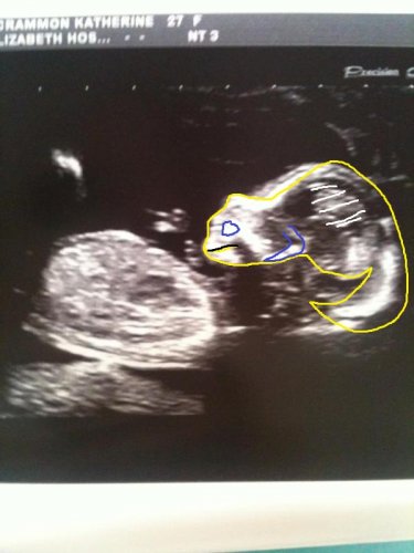 BabyBump15weeks chameleon.jpg