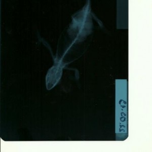 x-ray
