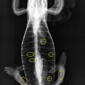 Multiple skeletal abnormalities