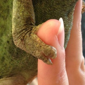 missing toenail