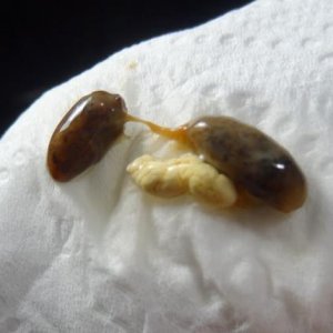 good pooping