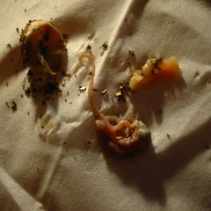 Embryo