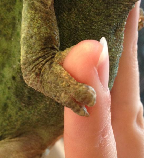 missing toenail