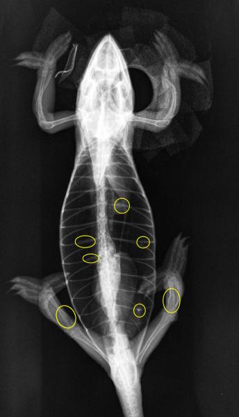 Multiple skeletal abnormalities