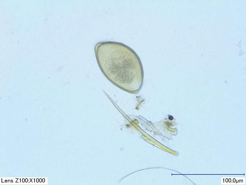 pinworm%204%20comp_zpscgnghbgi.jpg