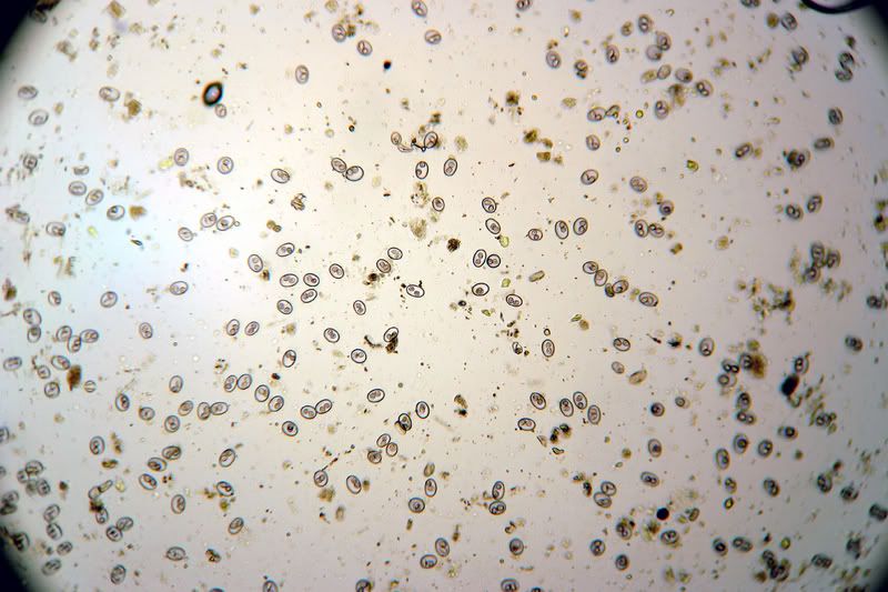 Coccidia100x.jpg