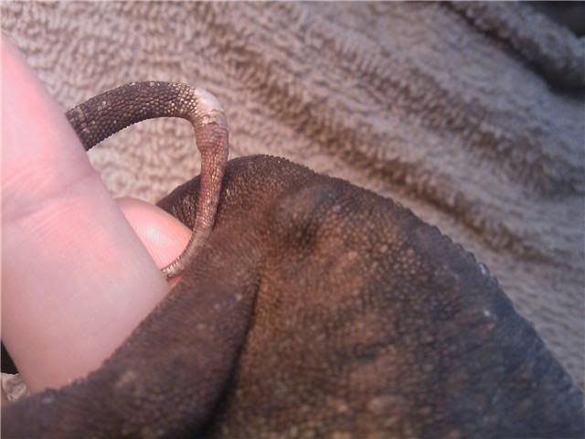 Swollenleg7.jpg