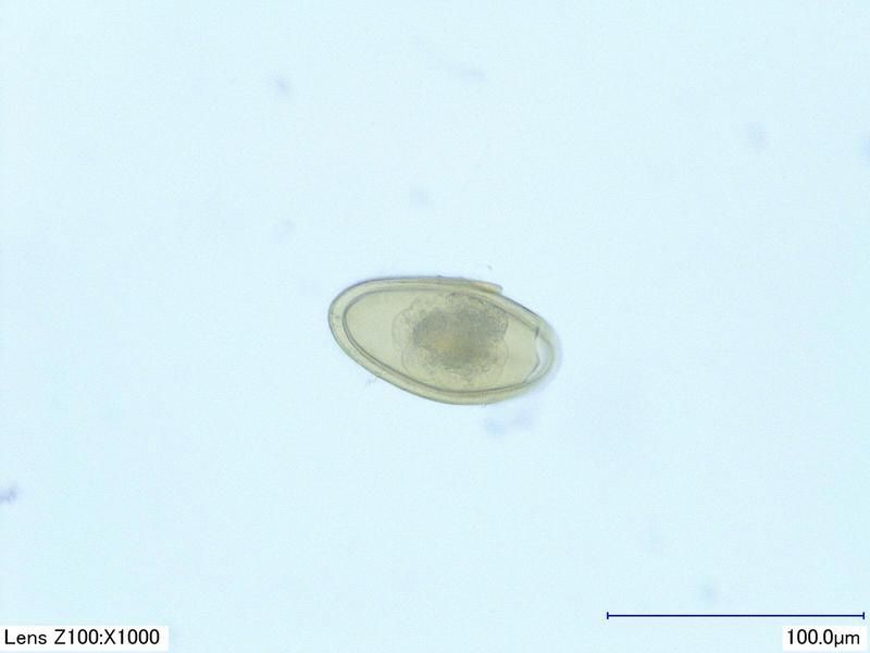 pinworm%201000x_zpsqe8cf8qo.jpg