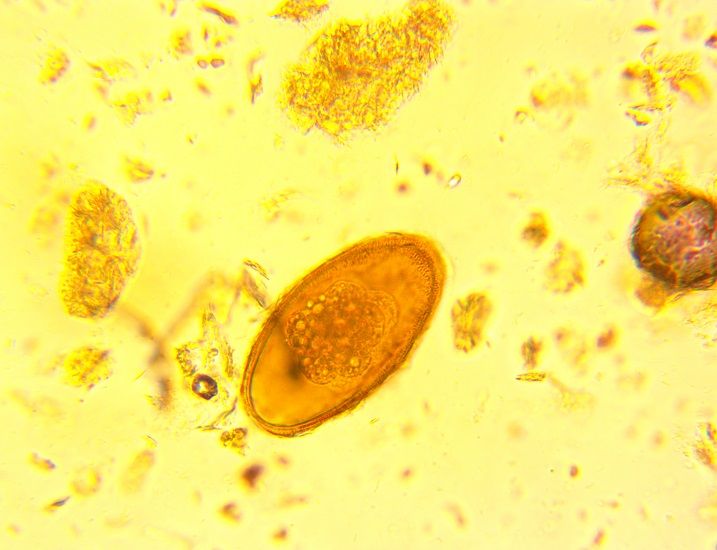 pinworm2.jpg