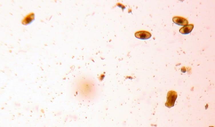Pinworm3.jpg