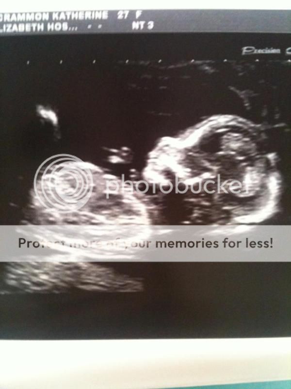 BabyBump15weeks.jpg