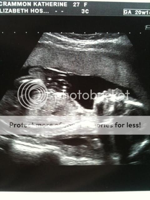 Babybump20weeks.jpg