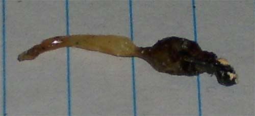 Fecal.jpg