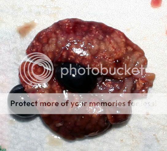 Kidneys1.jpg