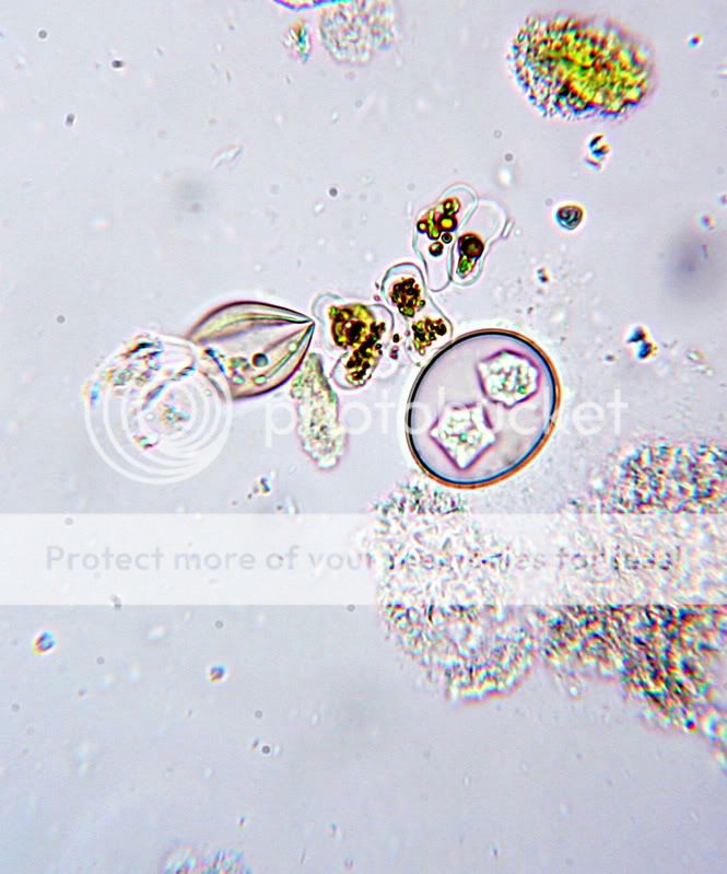 ProtozoanCroppedIMG_0013.jpg