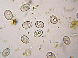 Parasites - Coccidia